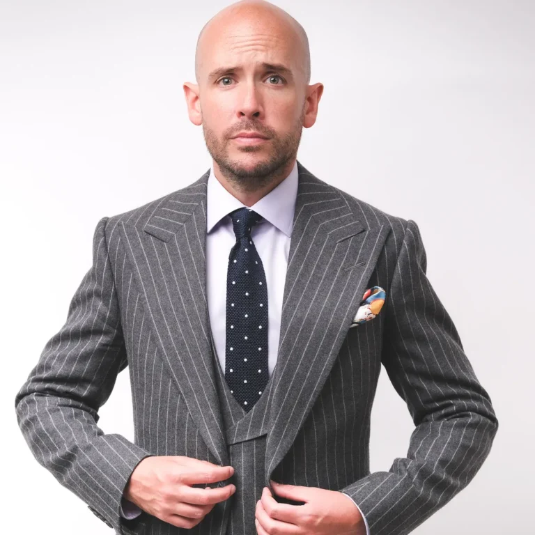 Why Does Tom Allen Have No Hair? New Look And Facial Hair Update