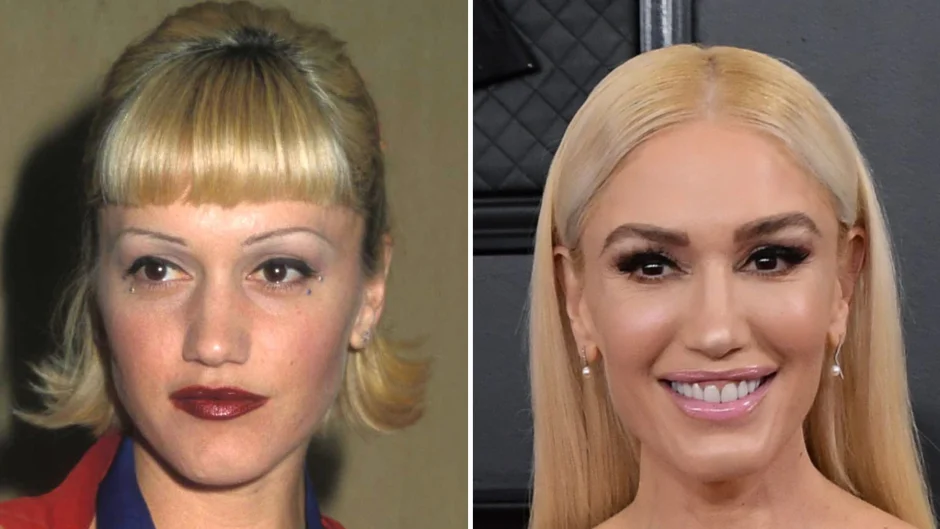 Gwen Stefani Transformation Plastic Surgery Speculation