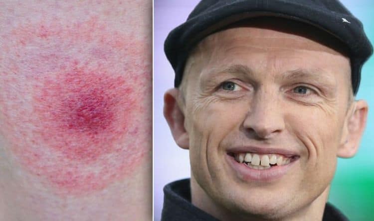 Matt Dawson health: 'It was really scary' - QoS star explains symptoms of deadly infection