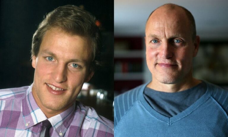 Is Woody Harrelson Bald Now, What Happened To His Hair?