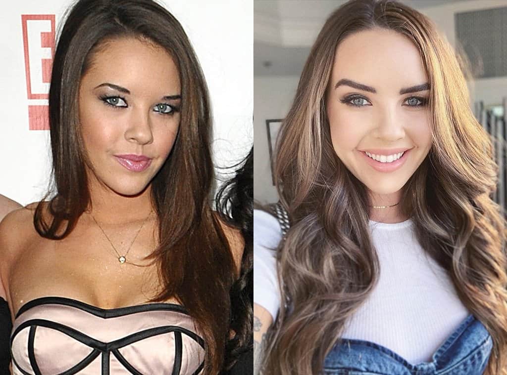 Alexis Neiers before and after Plastic Surgery
