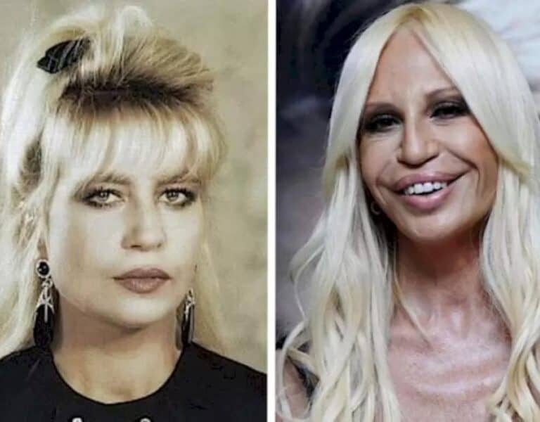 Donatella Versace Plastic Surgery Gone Wrong, What Happened To Donatella Versace Face?