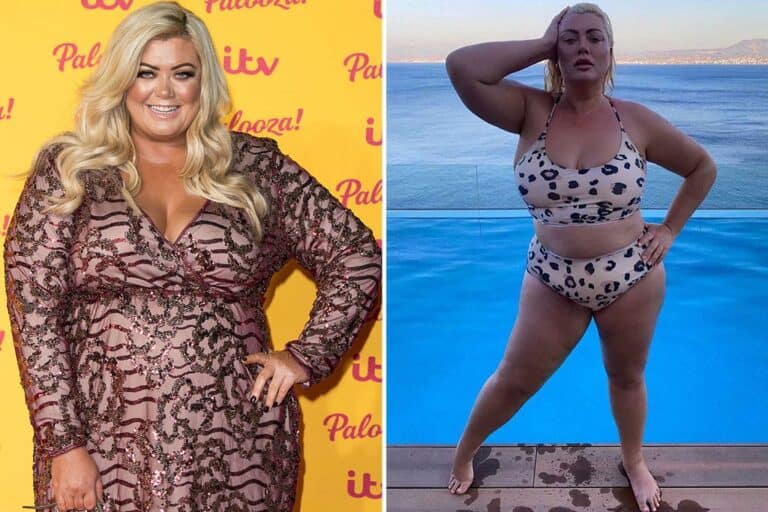 Gemma Collins Weight Loss Before And After: How Did She Lose Her Weight? Illness And Health Update