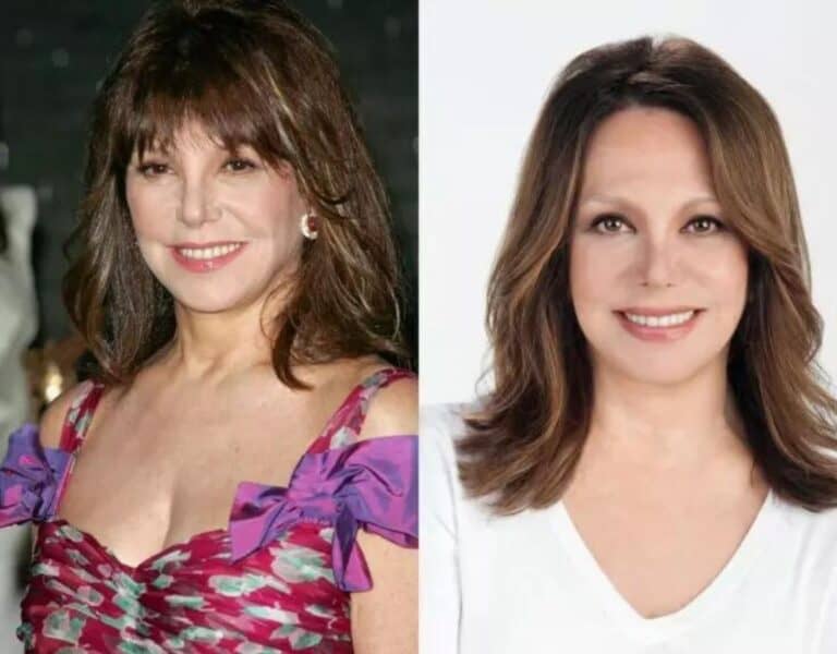 What Happened To Marlo Thomas Face? Plastic Surgery Before And After Photos