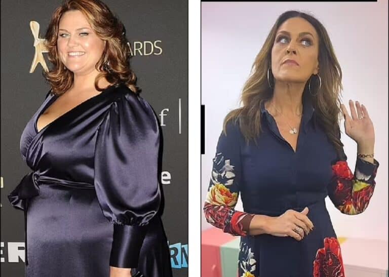 Did Chrissie Swan Had Weight Loss Surgery? Before And After