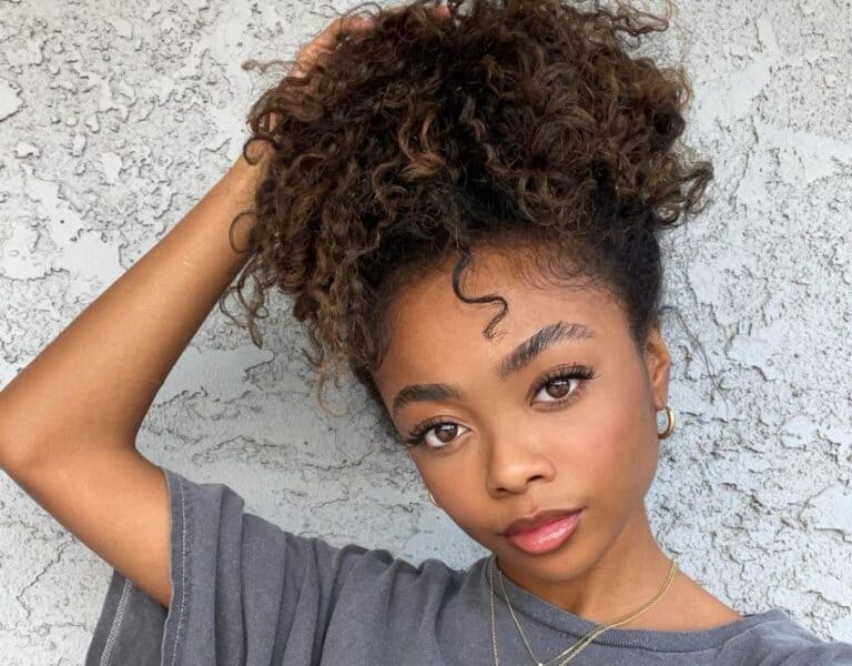 Skai Jackson Surgery Update: What Happened To Her Nose?