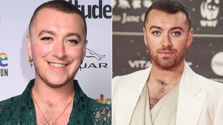 How Long Is Sam Smith Hair Now? Did He Cut it? Illness And Surgery Update